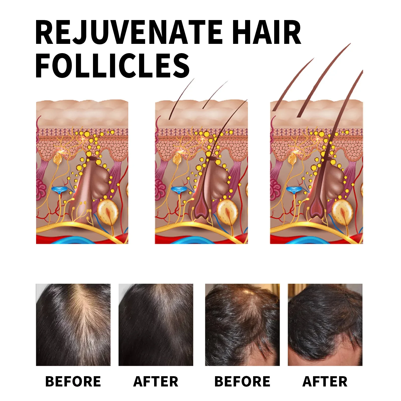 Produtos de crescimento capila - Hair Care For Dry And Frizzy Hair avaliação e preço