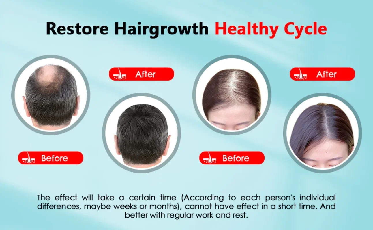 Tampa de crescimento capilar r - Hair Care With Protein avaliação e preço