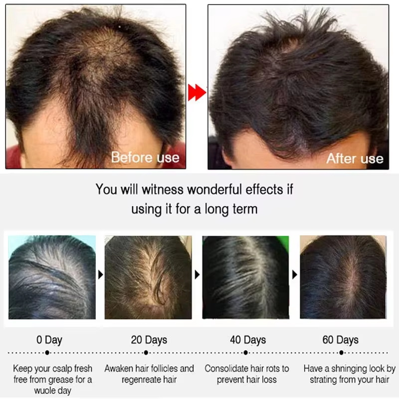 Spray de Crescimento Rápido de - Hair Care With Protein avaliação e preço